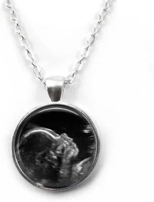 Custom Photo Ultrasound Necklace or Key Chain - Personalized Picture Jewelry - Sonogram Pendant - Birth Announcement Jewelry