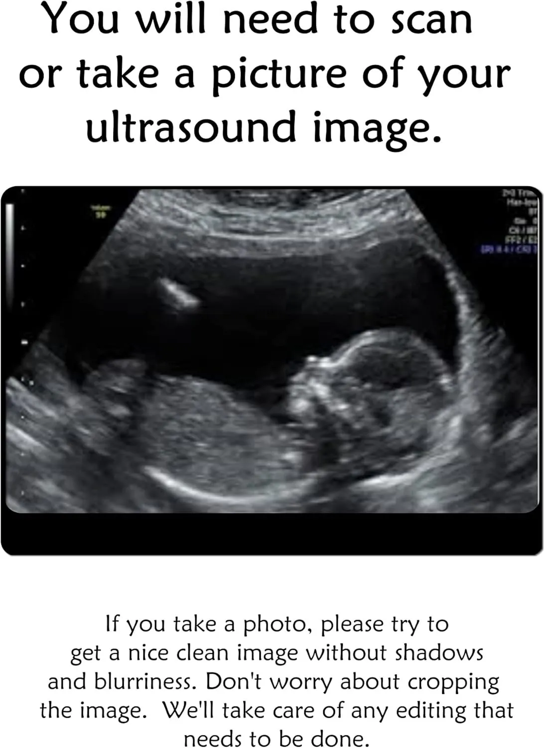 Custom Photo Ultrasound Necklace or Key Chain - Personalized Picture Jewelry - Sonogram Pendant - Birth Announcement Jewelry